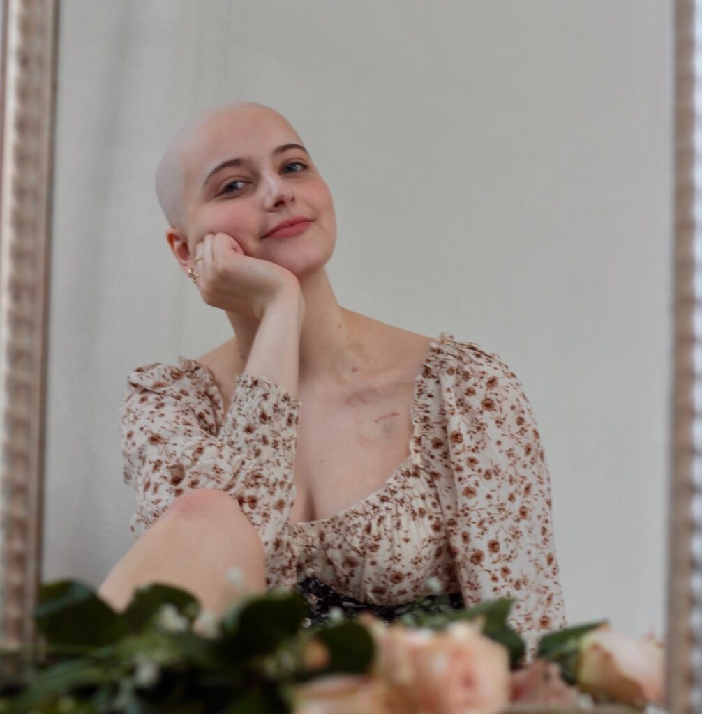 Delanee, patient with Stage 2A bulk Classical Hodgkin’s Disease
